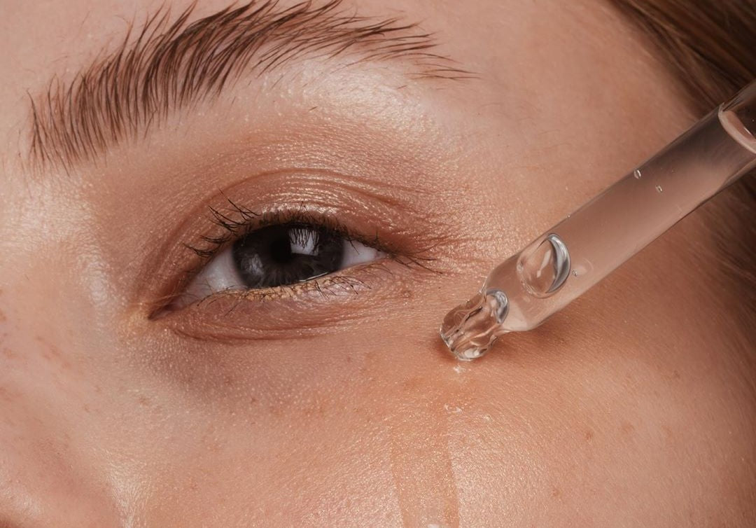 Diferencias entre ojeras vasculares/azules y pigmentarias/marrones
