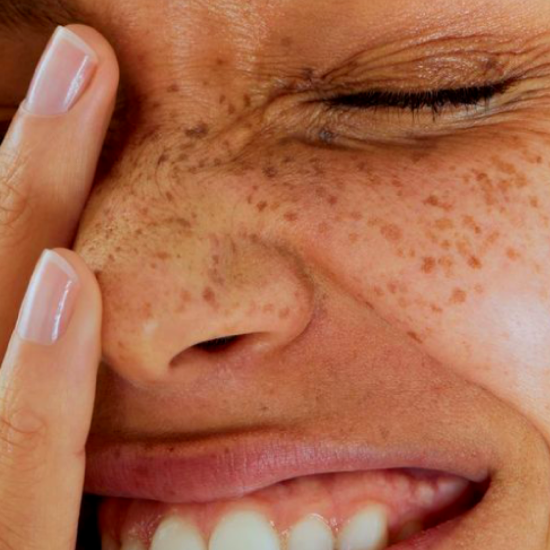 3 cosas que le diría a mi yo del pasado (Skincare Edition)