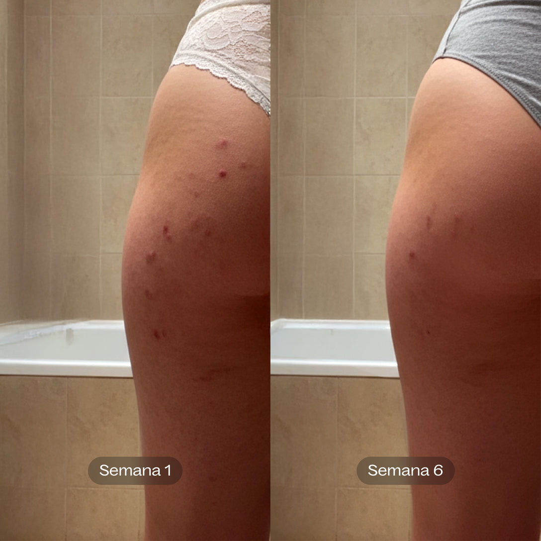 Soft Reset I Tónico Exfoliante