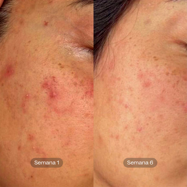 Pack Rutina Prebiótica PRO