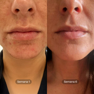 Soft Reset I Tónico Exfoliante