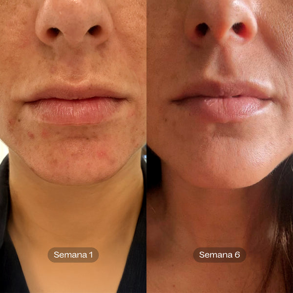 Soft Reset I Tónico Exfoliante