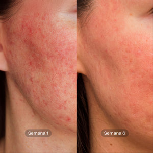 SOS Hydro Boost | Crema Hidratante