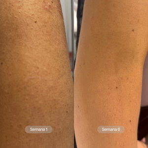 Soft Reset I Tónico Exfoliante