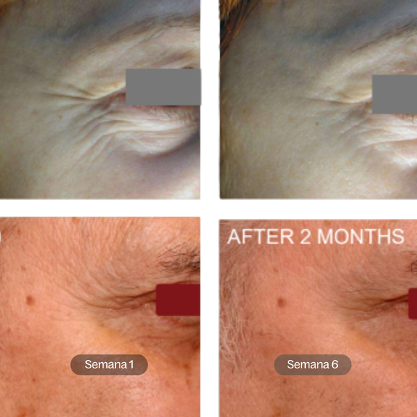 Smooth Complexion  | Sérum de Noche