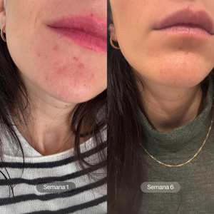 Smooth Complexion  | Sérum de Noche