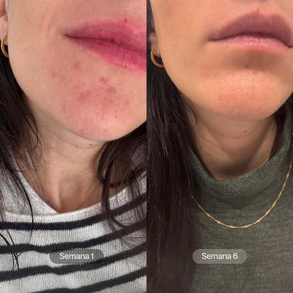 Smooth Complexion  | Sérum de Noche